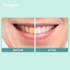 Rose Tooth Whitening Powder - Image 2